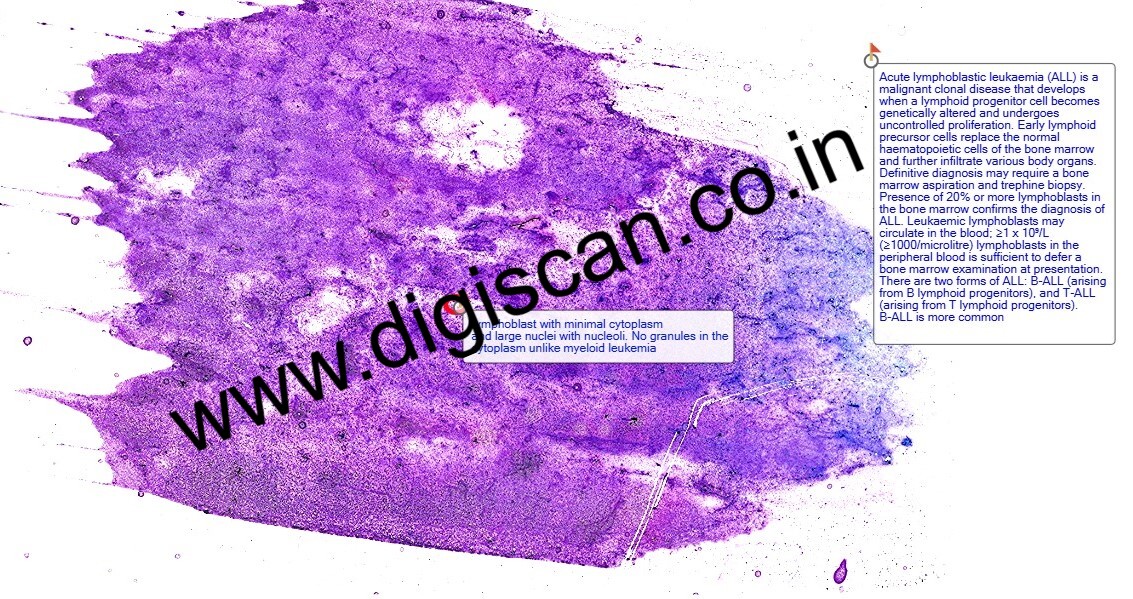 Hematology Digital Slides Set (Peripheral Blood Smear & Bone Marrow Slides)